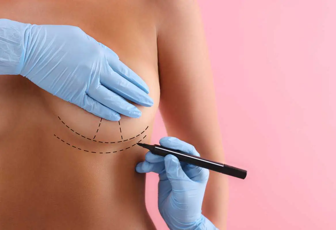 Breast Augmentation by Aestique Plastic Surgery in Greensburg PA