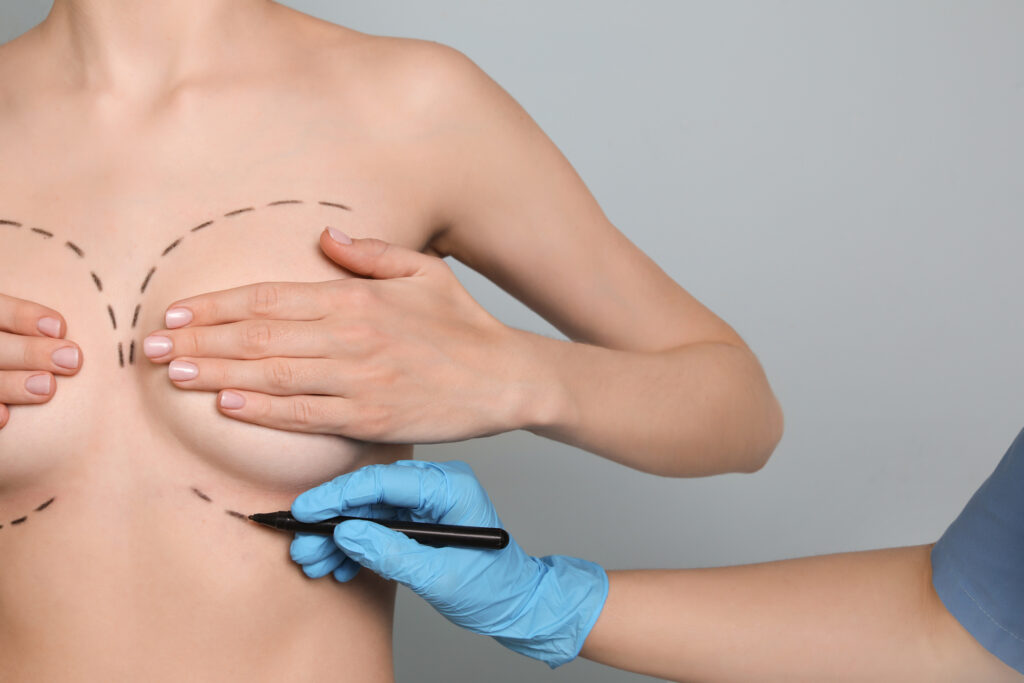 Breast Lift in Greensburg PA