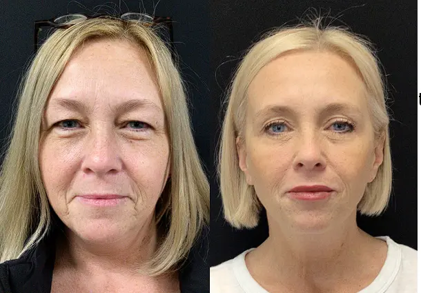 confidence-in-girl-face-after-weight-loss